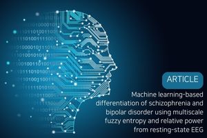 Distinguish Schizophrenia Bipolar Eeg
